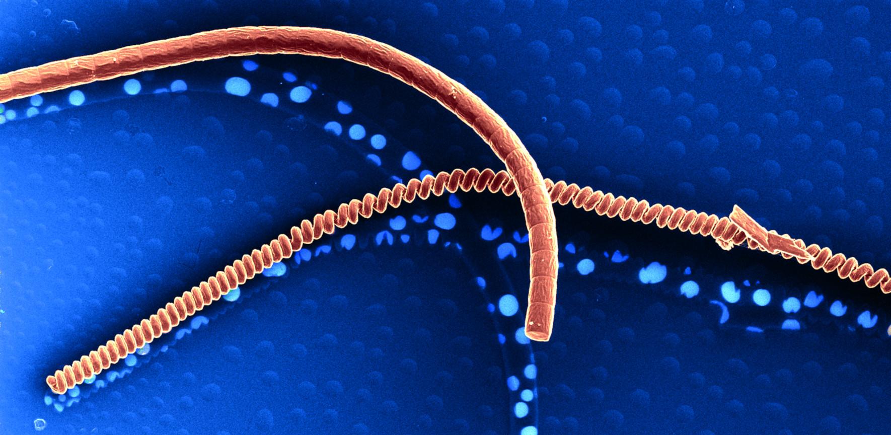 Orion NanoFab image of cyanobacteria at nanoscale